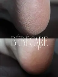 BÉBÉ CARE SPA®︎ 踵の角質除去🦶before → afterちゃんと変わる、かかとケア🦶✨