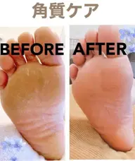 フット角質ケア ネイルとセットで更にお安くなります!