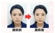 小顔整体