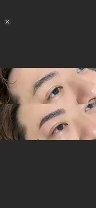 ワックス脱毛