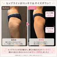 ✨【美脚・美尻】下半身集中痩身60分✨太もも・ふくらはぎ・ヒップを徹底ケアでシンデレラボディへ大変身✨¥3980
