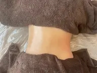 セルライトケアでスッキリ!(脚・お腹・腰・腕から選べます)