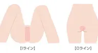 【その日にスッキリ♪】ブラジリアンシュガーリング／IOライン（回数：1回）【女性限定】