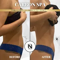 【🌿巡り×むくみ集中ケア】CARBON SPA(上半身or下半身選択)|温活×深部リリース〈都度払いOK〉
