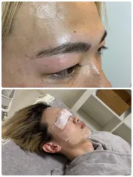 メンズアイブロウ 眉毛カット ワックス脱毛 おでこ、目の周り、頬などお顔のワックス脱毛 鎮静の為のパック付き!