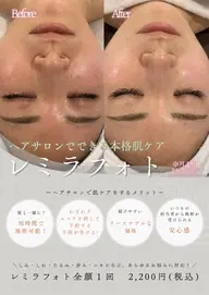 【透明感UP♪美肌フォト】 IPLの光でシミ・くすみ・毛穴・赤みにアプローチ♪