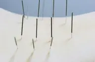 中国鍼の鍼施術4000円（1つの疾患のみ）