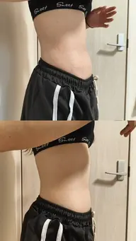 本格的な夏に向けて🌻【腹部徹底痩せ】キャビテーション