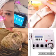 【リピーター様専用】ハーブピーリング🌿・ララピール・セラピール➕美容液選択導入(毛穴洗浄付)8,800円​〜​