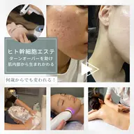 白玉肌フェイシャル60分