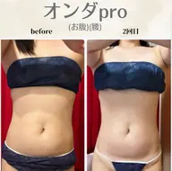 【お腹・腰】《当店イチオシ🩵》お腹なら絶対これ‼️浮き輪肉撃退!美くびれ集中ケア🔥