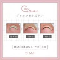 【フット】hey switch巻き爪ケア
