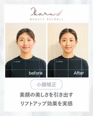 【期間限定モニター】小顔かっさ＋小顔矯正＋ヘッドケア 40分｜むくみ・フェイスラインをすっきりケア