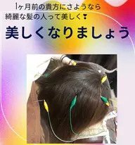メンズ/ヘアエステ鍼/髪の毛のハリツヤ✨元気に回復させましょう。💖