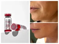最新小顔🤍REDSHOTでフェイスライン形成✨