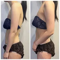 【姿勢×小顔】巻き肩/猫背改善で横顔美人に💆♀️✨小顔矯正+姿勢矯正