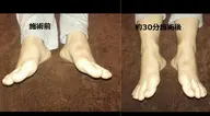 【下半身集中！むくみ・美脚ケア】骨盤調整＋脚の筋膜リリース＋足かっさ 75分