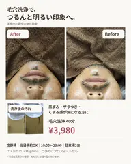 毛穴すっきりフェイシャル