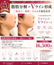 【人気No.1】顔脂肪×Vライン形成｜二重あご・頬肉・たるみ改善60分