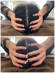 頭蓋骨調整