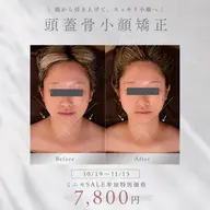 【10/19〜11/15⭐️ミニモSALE期間限定】頭蓋骨小顔矯正で小顔+頭の重さ・顔の疲れもスッキリ軽く♪