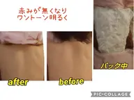 背中パワーストン泡エステ✨