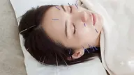 ✨【初回限定】美容鍼+頭・首・肩スッキリケア💆♀️✨💰3,980円💕