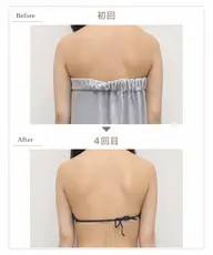 【部位別】痩身モニター様募集🍋6cc×4回【1回あたり¥12,450】