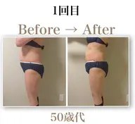 ボディメイクケア2カップ体験|気になる部分をやさしくケア