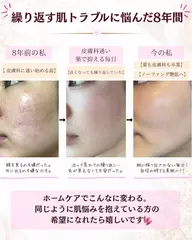 肌悩み別スキンケア体験
