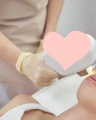 ✨【上唇の脱毛】美肌に導くワンショット脱毛 ✨