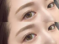 下マツパモデル