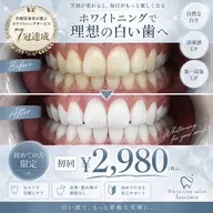 【迷ったらまずはこのクーポン♪】8分照射×2回セルフホワイトニング