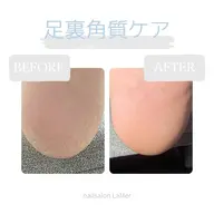 足裏角質ケア
