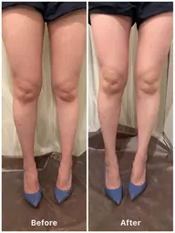 【ドレス映え!】足首キュっとトリートメント!美脚作りも!75分11,000円→7,500円