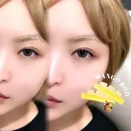 🇰🇷《韓国激レアロッド》まつパ👀マンゴーロッド🥭✨