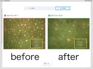 【迷う人はこれ】毛穴洗浄リポア(汚れ1回で綺麗に取りたい人◎)スチーマー・毛穴カメラ診断付き