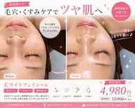 【毛穴・くすみ改善】透明感ツヤ肌フェイシャル☆通常¥12,000→初回限定¥4,980