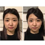 【初回限定お試しクーポン🌟】全身整体+骨盤矯正+小顔矯正 18,000円→3,000円