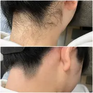 うなじWAX