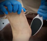 フットケア