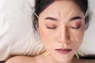 【3回¥9,000🪡1回¥3,000✨】人気の電気美容鍼💆‍♀️小顔・むくみ改善《渋谷/恵比寿》