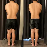 冷却ダイエット【筋膜リリース、引き締め美容液付き❗️】痩身❄️痩せたい部位の脂肪を集中アプローチ!1部位(2カップ)