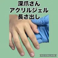 深爪対応 強い強度アクリルジェル長さ出し(ショート〜ミディアム)ワンカラーorラメグラ+ストーン6ケ(オフ込み)