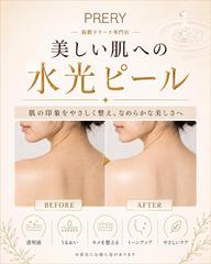 ブライダルにも☆★背中PHA水光ピール★☆【ニキビ・毛穴・くすみ】　¥9800