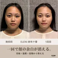 ✨お試し✨頭蓋骨小顔コルギ60分|フェイスラインをすっきり見せたい方へ🎁口コミで10分延長