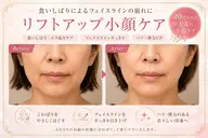 【食いしばり・エラ張り】顔のこわばりをほぐしてすっきり小顔フェイシャル
