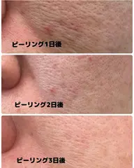 🧖♀️発光美艶ピーリング🧖♀️美白パック付
