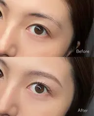 大人気🌸美眉Wax脱毛🌸 お顔立ちに合わせた美眉デザインをご提案♡