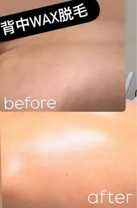 📢新規オープンキャンペーン人気の3点セット❤️🔥✨背中+うなじ+脇 WAX脱毛✨